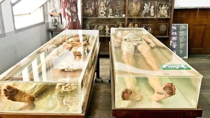 The Siriraj Medical Museum in Bangkok, also known as the "Museum of Death," offers a unique educational experience.